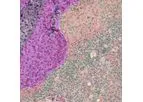 PathAI - Version PathExplore - Automated Tissue and Cell Detection Software
