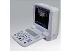 Landytop - Model 5000P - Portable Color Doppler Ultrasound Scanner
