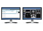Santesoft - Sante PACS Server - Medical Image Management Solution