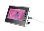 BESDATA - Portable Flexible Bronchoscope