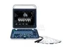 Shinova - Model DopScan 6060V - Portable Veterinary Color Doppler