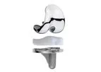 Evolution - Cemented Knee Systems