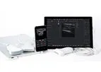 Telemed - Model MicrUs PRO - Open-Architecture B/W Ultrasound Diagnostic System