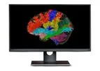 Synaptive ModusPlan - Patient-Specific Tractography System
