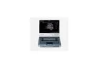EDAN Acclarix - Model AX8 - Diagnostic Ultrasound System