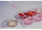 EndoBiobank - Regulatory Compliant Biobank for New Therapies