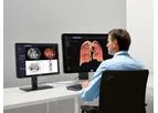 Siemens - Angiography