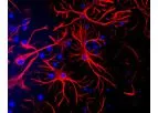 GFAP - Anti-Glial Fibrillary Acidic Protein Antibody
