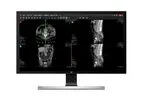 Suitestensa - Version UniViewer - Web Module