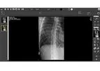 Magellan - Medical Image Processing Software
