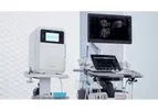 Nanosonics - Model trophon2 - Automated Ultrasound Reprocessing Systems