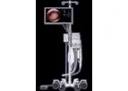 Aveta - Tissue Removal Solution