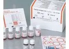 Febrile Antigens