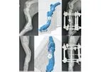 Steris - 3D Bone Prints