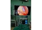 SHREK - Model BT550S - 4K UHD Medical Endoscope Monitor 55 Inch