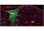 ExVive - 3D Bioprinted Human Liver Tissue