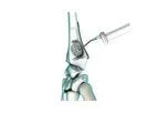Graftys - Model QuickSet - Calcium Phosphate Cement