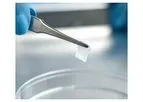 AmnioGuard - Umbilical Cord Graft Tissue