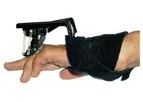 Age Digit Widget - Reverses PIP Flexion Contractures