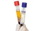 RegenATS - Model PRP - Leukocyte-Reduced Platelet Gel