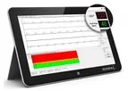 VectraplexECG - Cardiac Electrical Biomarker Software