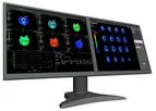 TeraRecon - Version Intuition 4.6 - Turning Medical Imaging into Great Medicine