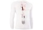 EXCOR - Model Venous Cannula - Subpulmonary Support for your Patients with Failing Fontan Circulation