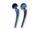 Konknow - Artificial Hip System