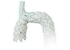 Endospan NEXUS - Aortic Arch Stent Graft System