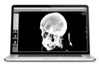 AlleRad - Version DICOM Reader-EXHB - Medical Imaging Software