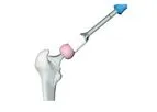 EasyHip - Model E-900 - Ceramic & CoCr Heads