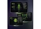 Avalanche - Model Plus - 32-Channel Neuromonitor for Neuro- and Spine Surgery