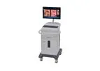 LungPoint - Virtual Bronchoscopic Navigation System
