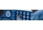 Cortical Disarray Measurement Technology