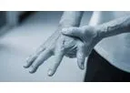 Stem Cell Therapy for Arthritis