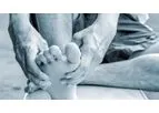 Stem Cell Therapy for Foot & Ankle Pain