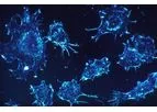 AIVITA - Cancer Immunotherapy