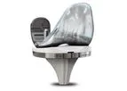 Sterizo - Total Knee System