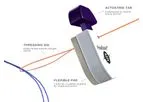 Inari Medical - Model FlowStasis - Suture Retention Device
