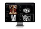 Xelis - 3D Diagnosis Support Solution