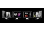 Myrian® - Version 2.13 - Software for Medical Imaging Layer