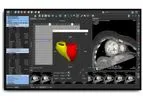 Medis Suite - Version CT - Vendor Independent Post Processing Software