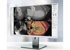 3mensio - Mitral Valve Regurgitation Software