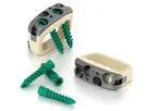 Dyna-Link - Model Elite - Stand-Alone Anterior Lumbar System