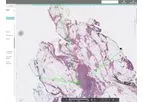 Halo - Version AP - Anatomic Pathology Workflow Software