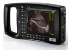 Welld - Model WED-3100 - Palm-Size Full-Digital Ultrasound Diagnostic System