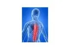Meagan - Model DISCSS - Dynamic Interferential Spinal Cord Stimulation System
