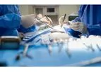 Solid Organ Transplantation Services