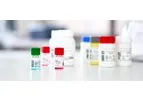 SERION - Model ELISA Classic / Antigen - Diagnostic for Quantitative Immunoassays for the Detection of Human Antibodies