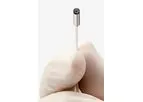 ScoutCam - Bronchoscopy Cameras & Bronchoscopy Equipment